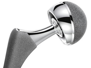 metal-on-metal hip replacement devices