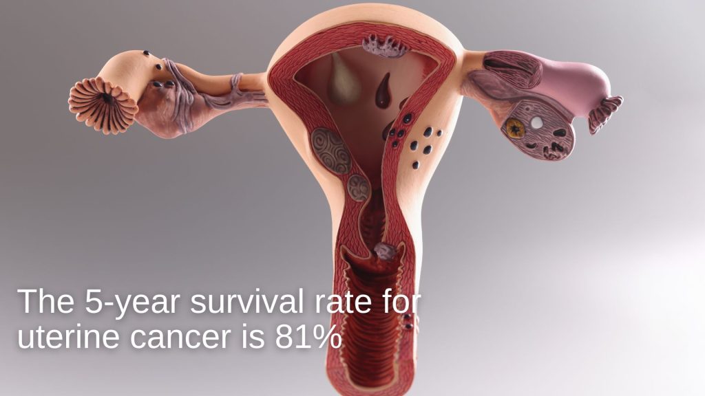 uterine cancer