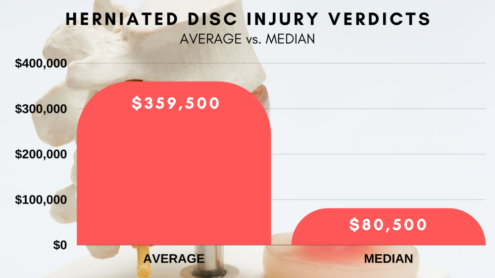 Herniated Disc Lawyer for Your Claim