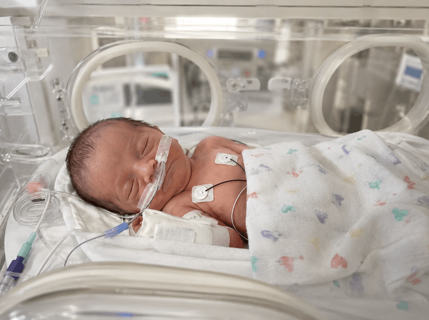 california birth injury lawyer